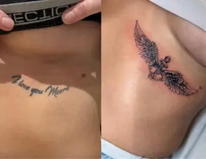 cover up tattoos Essex